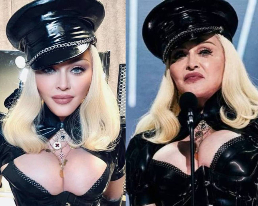 Как выглядит Мадонна в корсете и колготах в сетку?