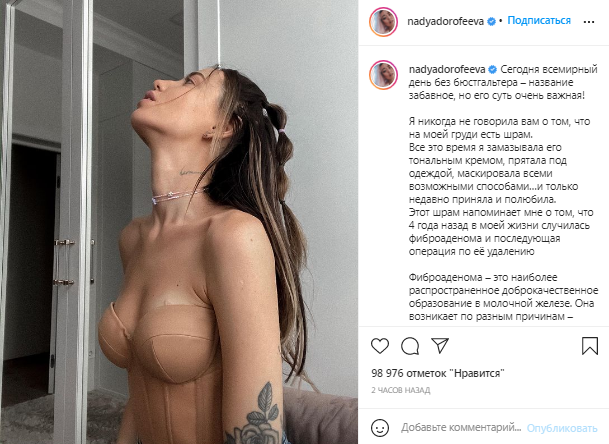 Надя Дорофеева показала шрам на груди