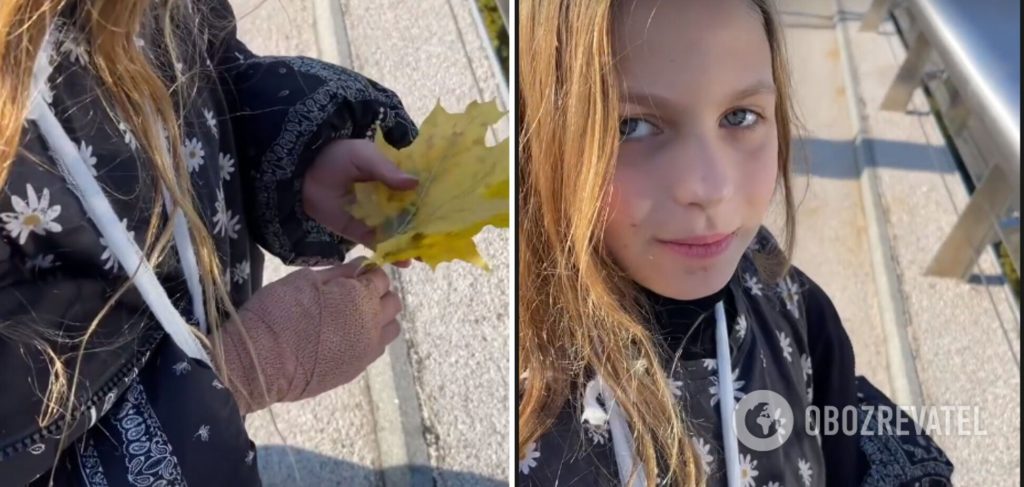 10-летнюю дочку Оли Поляковой покусал кот
