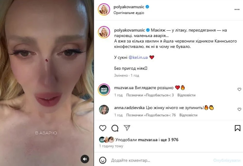 Полякова втрапила в дтп