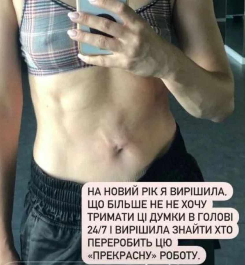 Українські знаменитості, чия зовнішність постраждала від пластики
